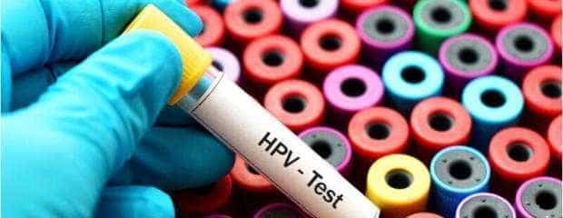 Testare HPV gratuită la Călinești
