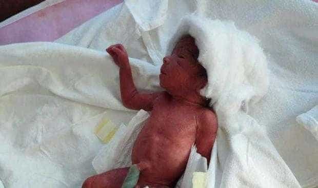 Bebeluş de 500 de grame, născut prematur la Spitalul Orășenesc Hârşova, transferat la Spitalul Judeţean Constanţa