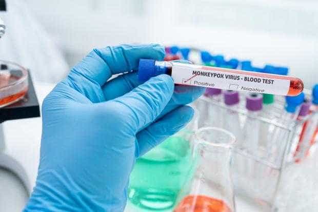 România a primit primele doze de vaccin împotriva variolei maimuței