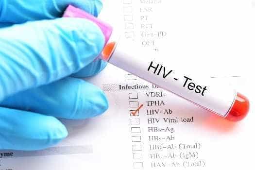Prima aplicaţie din România pentru testarea HIV