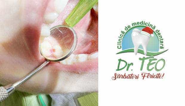 Clinica de medicină dentară Dr. TEO – Zâmbim oricând împreună!<br>PEDODONŢIA