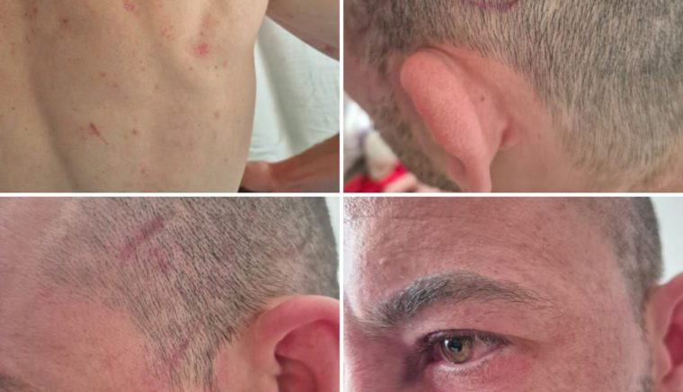 Răspuns în cazul incidentului petrecut pe 2 mai la sediul Poliţiei Câmpulung. IPJ Argeş: „S-a întocmit dosar penal şi se fac verificări interne”