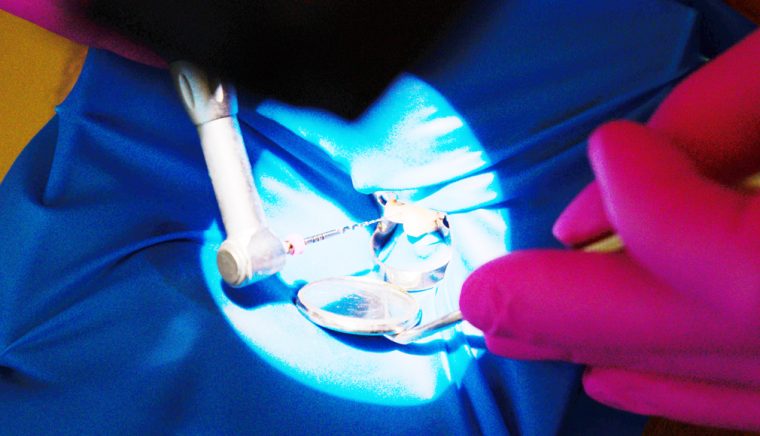 Clinica de medicină dentară Dr. TEO – Zâmbim oricând împreună! Coroanele dentare