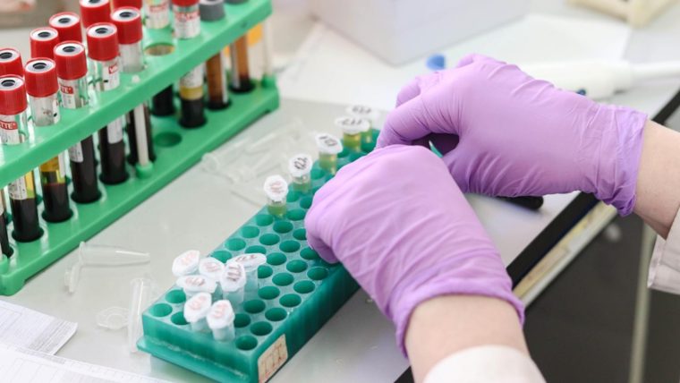 Alertă medicală: primul caz uman confirmat cu parazitul care distruge țesuturile