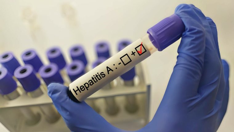 Șapte focare de hepatită A confirmate într-un județ din România