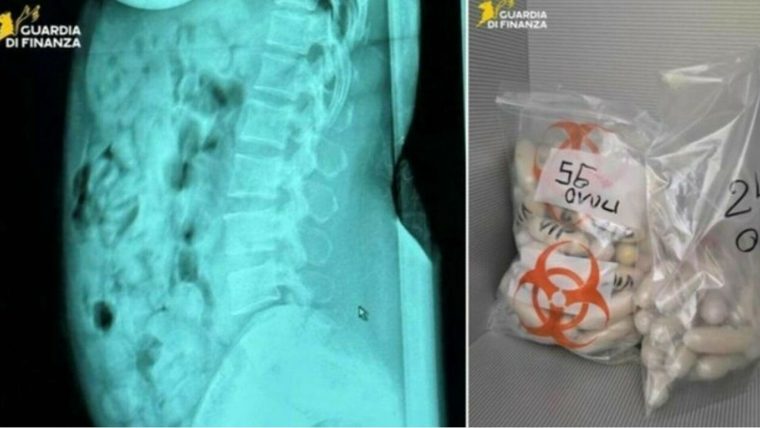Româncă arestată pe un aeroport din Italia, după ce a fost prinsă cu aproape 1,4 kg de droguri în stomac