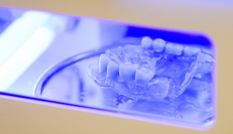 Clinica de medicină dentară Dr. TEO – Zâmbim oricând împreună! Protezele dentare cu capse pe implanturi