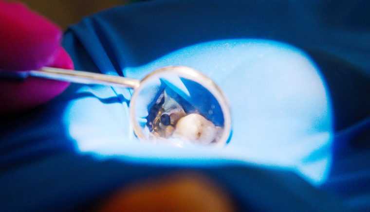 Clinica de medicină dentară Dr. TEO – Zâmbim oricând împreună! Importanţa endodonţiei