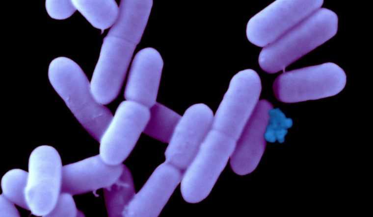 Bărbat mort după ce s-a infectat cu Listeria, o bacterie transmisă prin consumul de alimente contaminate
